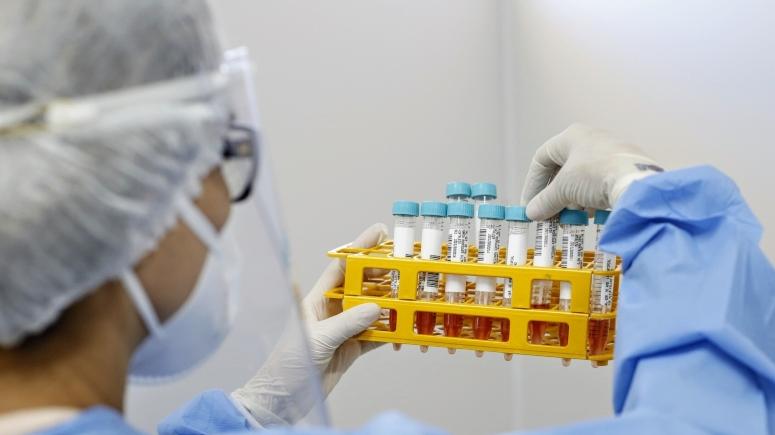 Testes Covid: após fechamento de centros, saiba onde fazer exames grátis no CE