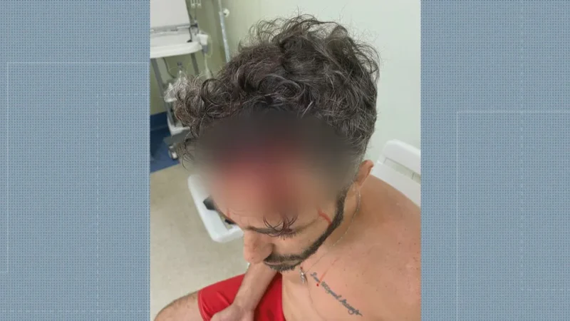 Imagem mostra ator Thiago Rodrigues ferido após assalto na Gávea