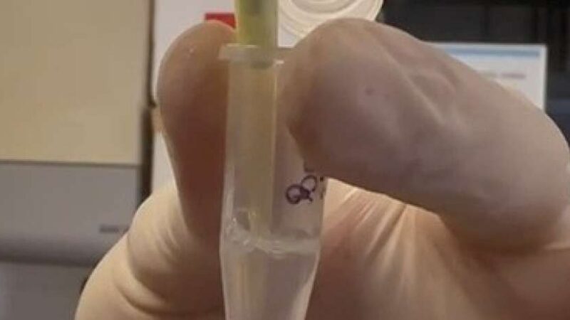 Tratamento inédito será aplicado pela Uece em crianças com Síndrome de Rett